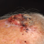 Online course aims to raise awareness of construction-related occupational cancers